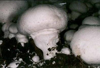 گود افتادگی ساقه (جوراب شل)