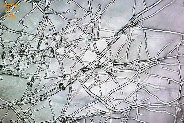 ساختار نخینه