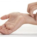 قارچ و آلرژی یا حساسیت پوستی یکی از انواع شایع آلرژی ها است