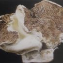 اختلال تاج خروسی یا رز کمب بیماری تاج خروسی در قارچ